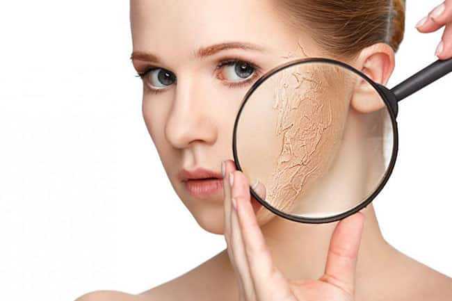 Cách chăm sóc cho làn da khô như thế nào để cải thiện tình hình